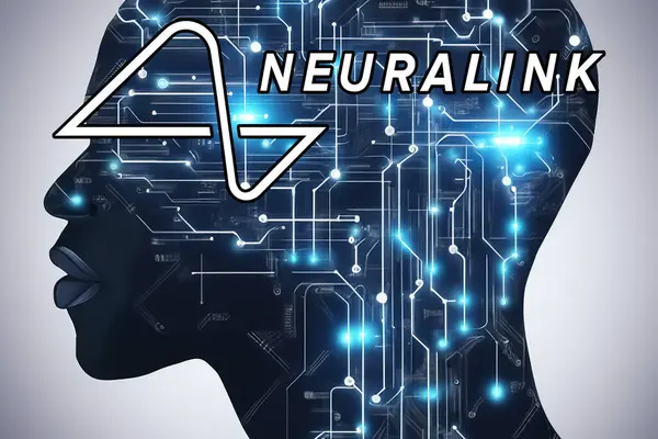 stock image Neuralink. Elon Musk artificial intelligence. Neuralink has a device capable of treating patients suffering from neurological disabilities. It is an implant with a series of wires and electrodes.