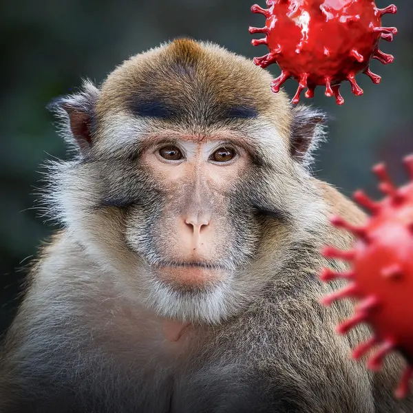 stock image Mpox. Clade 1b. Monkeypox. Monkeypox blisters on arm. Virus, epidemic, disease. New, more lethal strain of monkeypox virus alerts WHO. Deadly new strain of monkeypox could trigger pandemic. Strain: clade 1.