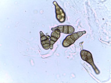 Genişletilmiş, oval şekilli, farklı segmentli yapılara sahip, temiz bir arkaplanda yüzen mikroorganizmaların mikroskobik görüntüsü.