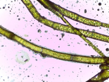 Yeşil Filamentous Alglerinin Mikroskobik Görünümü