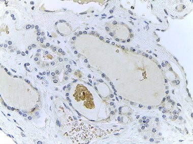 Mikroskobik Doku Analizi Fotoğrafı 