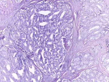 Lekeli Hücreli Mikroskobik Doku Yapısı