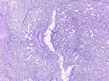 Mikroskobik Doku Örnekleme Analizi