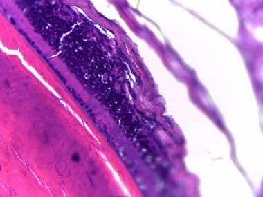 A microscopic view of a biological tissue sample, showcasing various cellular structures and staining patterns in vibrant purple and pink hues. clipart