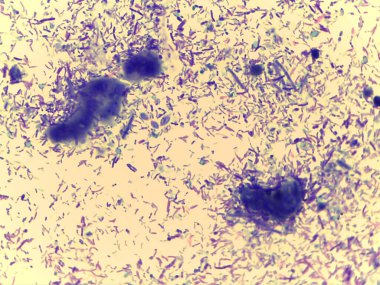 Bakteri ve diğer küçük yaşam formları da dahil olmak üzere çeşitli mikroorganizmaların mikroskobik görüntüsü, renkli bir arka planda çeşitli şekil ve boyutlarda sergilenmektedir..