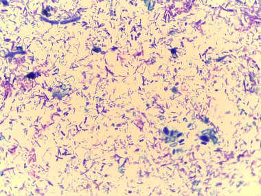 Bakteriler ve muhtemelen ökaryotik hücreler de dahil olmak üzere çeşitli mikroorganizmaların renkli ve lekeli bir şekilde mikroskobik bir görüntüsü. Görüntü, zengin bir mikrop topluluğunun göstergesi olan çeşitli şekil ve boyutlarda yoğun bir alan gösteriyor..