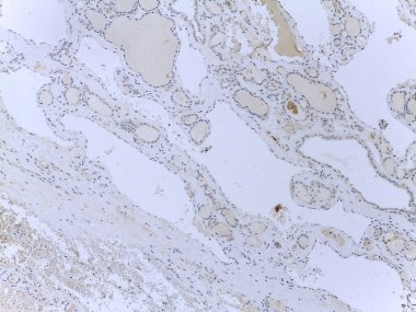 Düzensiz desenleri ve şekilleri olan, soyut sanat veya doğal oluşumlara benzeyen dokulu bir yüzeye yakından bakmak. Renkler ağırlıklı olarak hafif ve ince varyasyonlu..