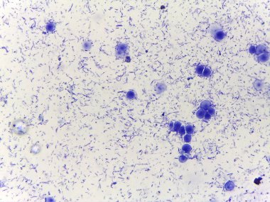 Mavi renkli bakteri ve protozoa gibi çeşitli mikroorganizmaların mikroskobik görüntüsü. Görüntü, mikrobiyal yaşamın karmaşıklığını vurgulayan çeşitli şekil ve boyutları gösteriyor..