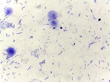 Bakteri ve protozoa da dahil olmak üzere çeşitli mikroorganizmaların mikroskobik görüntüsü soluk bir arkaplanda açık mor bir renkte sergilenmektedir..