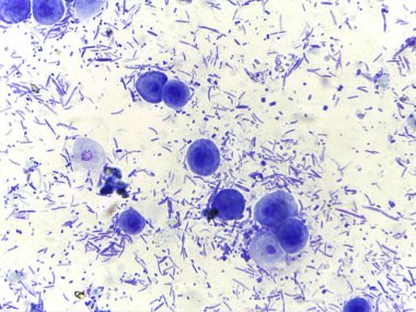 Bakteri ve muhtemelen protozoa da dahil olmak üzere çeşitli mikroorganizmaların maviye boyanmış mikroskobik görüntüsü. Görüntü, mikrobik yaşamın karmaşıklığını vurgulayan çeşitli şekil ve boyutları gösteriyor..