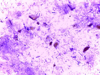 Mikroskobik bir görünüm, çeşitli hücresel yapıları ve mor lekeli arkaplandaki parçacıkları gösteriyor. Görüntü, biyolojik örnekleri gösteren şekil ve boyutların bir karışımını içeriyor..