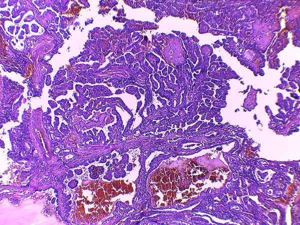 Mor renkte boyanmış doku örneklerinin mikroskobik görüntüsü karmaşık hücresel yapıları ve kalıpları gösteriyor. Histolojik analizlerde tipik..