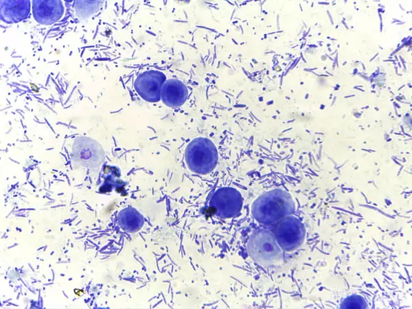 Bakteri ve muhtemelen protozoa da dahil olmak üzere çeşitli mikroorganizmaların maviye boyanmış mikroskobik görüntüsü. Görüntü, mikrobik yaşamın karmaşıklığını vurgulayan çeşitli şekil ve boyutları gösteriyor..