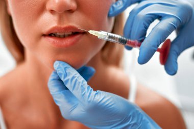Tıbbi kozmetik tedavileri botoks enjeksiyonu. Güzellik uzmanı kadının yüzünü hyaluronik asit doldurucuyla kaplıyor. Hyaluronik asit doldurucu iğneyle ya da kanülle enjekte edilir. Yüz hatları konsepti.