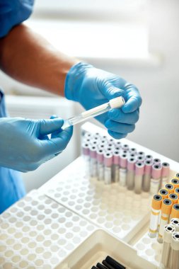 Eldiven giyen çok yetenekli bir laboratuar teknisyeni titizlikle bir kan örneği tüpü hazırlıyor. Bu da tıbbi test alanındaki kalite kontrolünün hayati önemini vurguluyor.