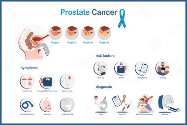 Prostat kanseri, semptomlar, risk faktörleri ve prostat kanserinin teşhisi. Beyaz arka planda izole edilmiş..