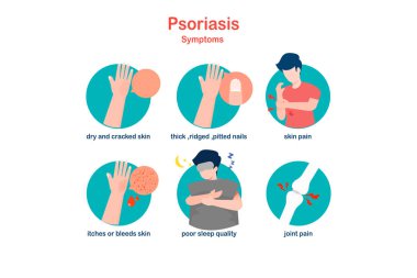Sedef hastalığı belirtileri. Düz tıbbi illüstrasyon kavramı.