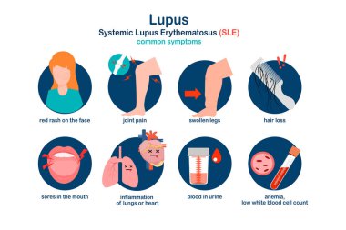 Düz tıbbi illüstrasyon. Sağlık sigortası konsepti. Lupus veya Sistemli Lupus Eritematoz (SLE).