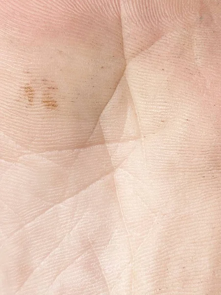 Close Foot Skin Texture — Stock Photo, Image