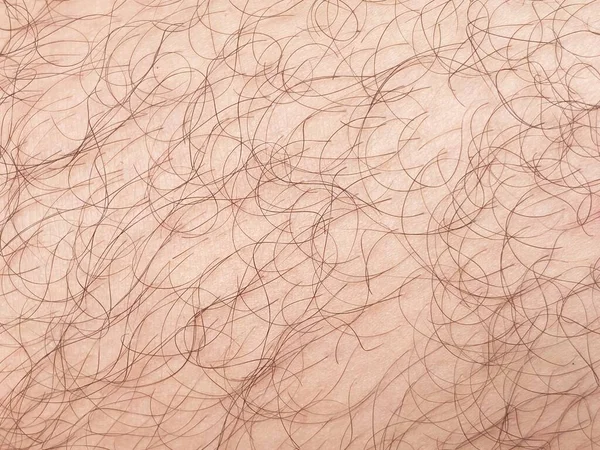 Close Fur Body Skin — Stock Photo, Image