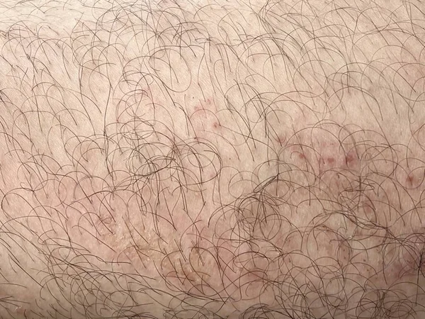 Abstrakt Bakgrund Mänsklig Hud — Stockfoto