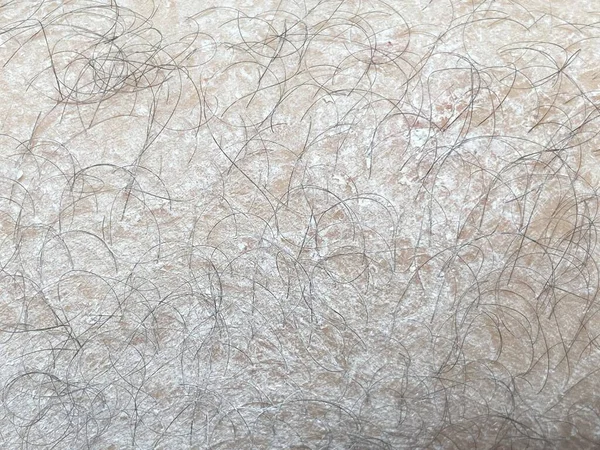Κοντινή Σκόνη Στο Ανθρώπινο Δέρμα — Φωτογραφία Αρχείου