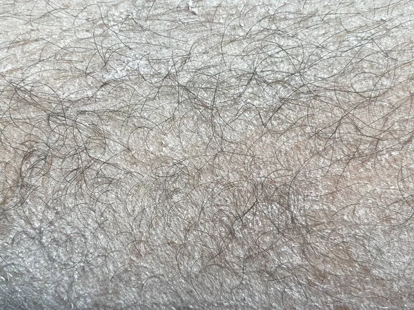 Närbild Pulver Mänsklig Hud — Stockfoto