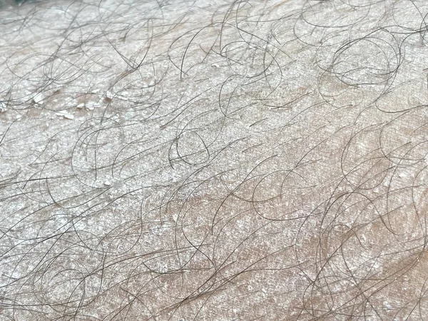 Textura Pele Corpo — Fotografia de Stock