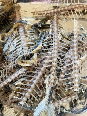 Yemekten sonra balık kemiğini kapat