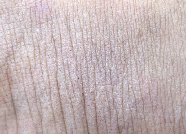 Close Skin Texture — Fotografie, imagine de stoc