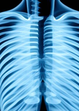 x-ray film of lungs human