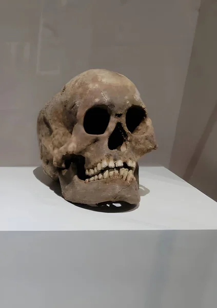白骨の人間の頭蓋骨だ — ストック写真