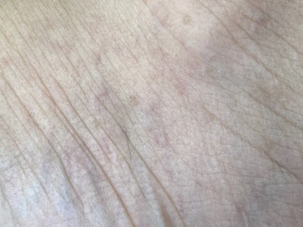 Close Του Φόντου Υφή Του Δέρματος — Φωτογραφία Αρχείου