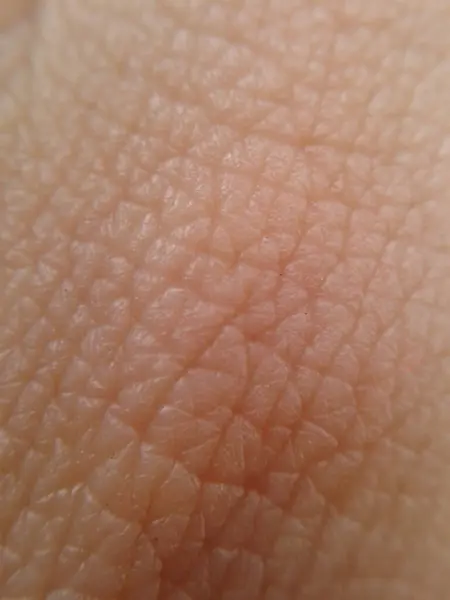 Zavřít Lidské Kůže Textury Pozadí — Stock fotografie