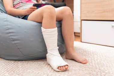 Alçılı bacağı kırık bir çocuk koltukta oturuyor..