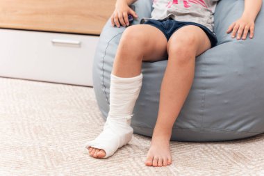 Alçılı bacağı kırık bir çocuk koltukta oturuyor..