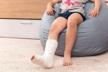 Alçılı bacağı kırık bir çocuk koltukta oturuyor..