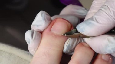 Ayak hastalıkları uzmanı ayak tırnağının etrafındaki kuru deriyi kesiyor.