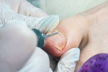 Profesyonel hırdavatçı, ayak hastalıkları uzmanı, tırnak değirmeniyle çivi temizleme uzmanı..