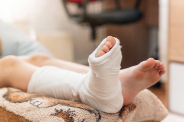 Çocukların bacakları kırık ve alçıda..