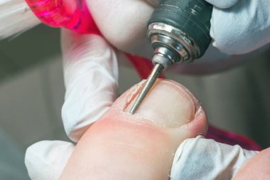 Profesyonel hırdavatçı, ayak hastalıkları uzmanı, tırnak değirmeniyle çivi temizleme uzmanı..