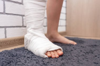 Çocukların bacakları kırık ve alçıda..