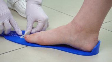 Ayak hastalıkları uzmanı hastanın ayak ölçüsünü ölçer ve özel bir ortopedik taban üretimi yapar.