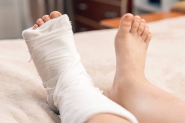 Kırık bacağı alçıdan yapılmış küçük bir kız yatakta yatıyor..