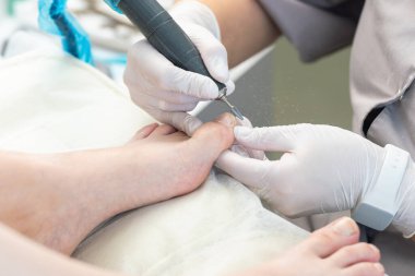 Profesyonel hırdavatçı, ayak hastalıkları uzmanı, tırnak değirmeniyle çivi temizleme uzmanı..