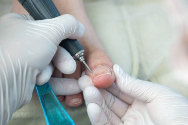 Profesyonel hırdavatçı, ayak hastalıkları uzmanı, tırnak değirmeniyle çivi temizleme uzmanı..