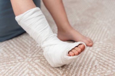 Çocukların bacakları kırık ve alçıda..