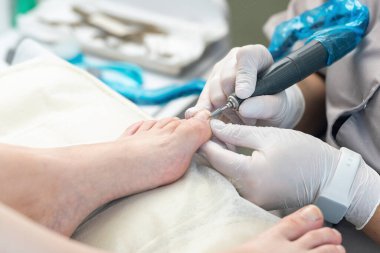 Profesyonel hırdavatçı, ayak hastalıkları uzmanı, tırnak değirmeniyle çivi temizleme uzmanı..