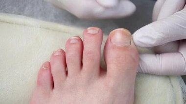 Doktor pediatrist ameliyattan önce hastanın ayak tırnağını muayene eder.