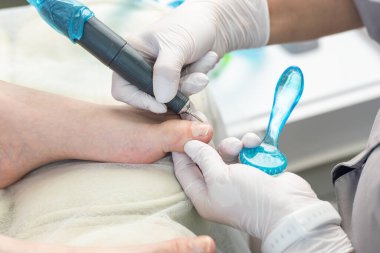 Profesyonel hırdavatçı, ayak hastalıkları uzmanı, tırnak değirmeniyle çivi temizleme uzmanı..